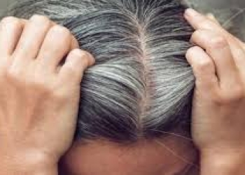Saçların erkən yaşda ağarmasının qarşısını necə alaq?