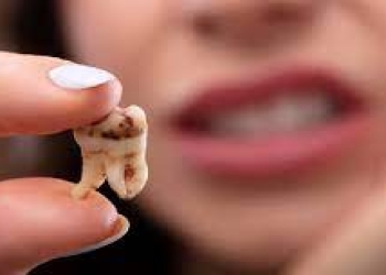 Həkim vegetarianlığın dişlərinizi necə “öldürə” biləcəyini izah edib
