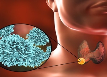 Tiroid vəzi problemləri ilə sağlam mübarizə