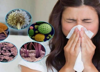 Allergiya nədir?