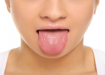 Dilin rəngi hansı şərtləri göstərir?