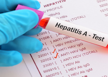 Hollandiyada hepatitin yayılmasının səbəbi tapılıb