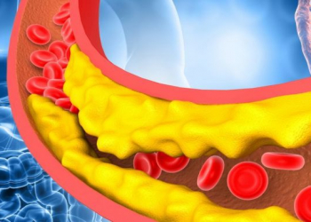 Xolesterol səviyyəsini azaltmaq üçün bir nömrəli protein