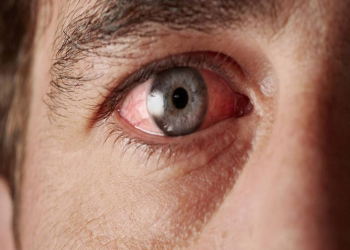 Gərginsinizsə bu vitamininiz çatışmır