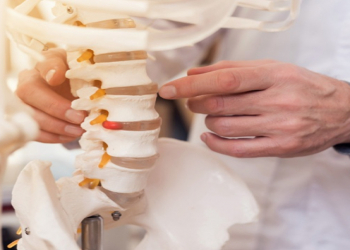 Daimi əzələ gərginliyi: Hiperlordoz nədir və necə müalicə olunur