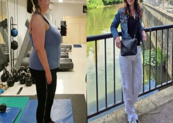 37 yaşında 79 kilo arıqladı: “Ac qalaraq səhv etdiyimi sonradan anladım”