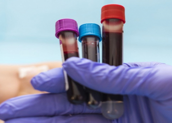 Qan zülallarının sağlamlıq proqnozunda rolunu açıqlandı