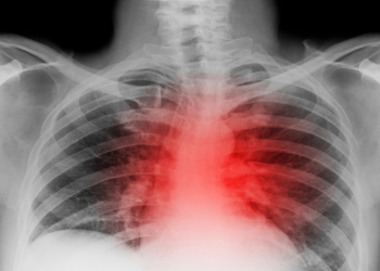 Yüngül və balanslı qidalanma ürəyi qoruyur