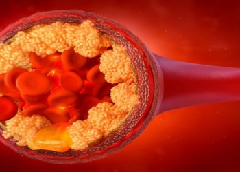 Qanda xolesterini aşağı salan meyvə