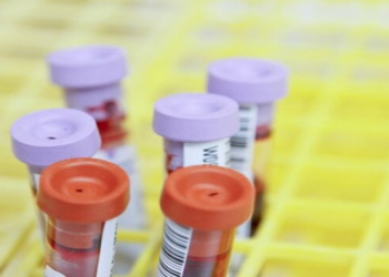 Yüksək kreatinin nə deməkdir? – həkim açıqladı