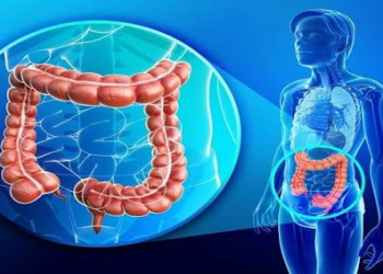 Yoğun bağırsaq və düz bağırsaq xərçəngi artıq yalnız yaşlıların xəstəliyi deyil.