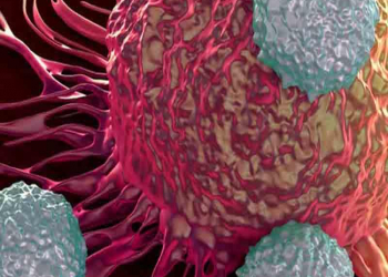 Xərçəng riskini azaldan sadə vərdişlər