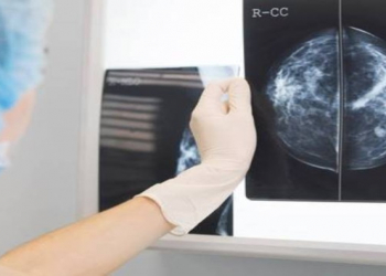 Ürək  xəstəlikləri riskini aşkar etməyin gözlənilməz yolu