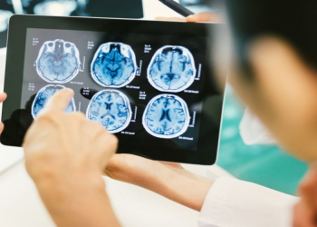 Şəkərli diabetlə Alzheimer xəstəliyi arasında yeni əlaqə aşkarlandı