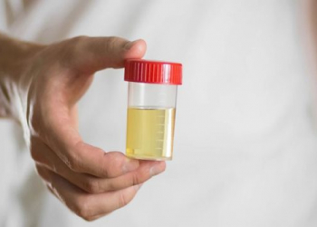 Sidikdə köpük: Sadə hal, yoxsa ciddi xəstəliyin əlaməti?