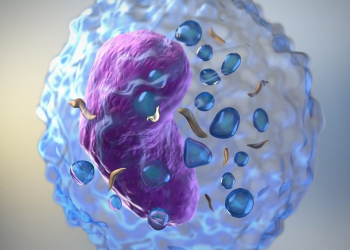 Limfomanın əsas simptomları nələrdir?