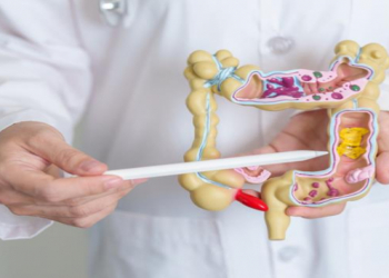 Yoğun bağırsaq xərçənginin əsas səbəbləri