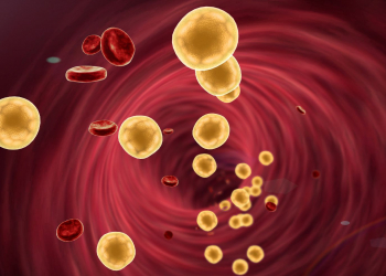 Dərmansız iki günə xolesterini azaltmağın yolu