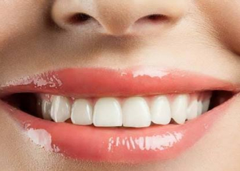 Dişlər ümumi sağlamlığın güzgüsü ola bilər