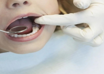 Dildə yaranan çatlar nədən xəbər verə bilər?