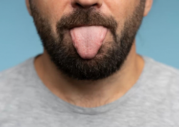 “Coğrafi dil” nədir? - Həkim açıqladı