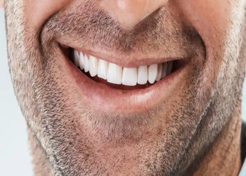 Parlaq və ağ dişlər üçün 5 təbii qida