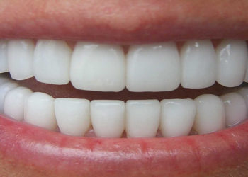 Dişlərə qulluqda ən çox edilən səhvlər açıqlandı