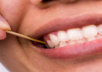 Dişləri şirniyyatlardan daha tez "öldürən" beş vərdiş