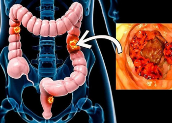 Bağırsaq sağlamlığını gücləndirən qidalar açıqlandı