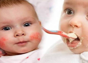 Körpələrdə qida allergiyasının qarşısını necə almaq olar?