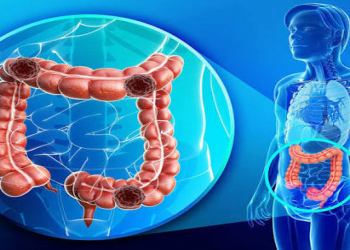 Sağlam bağırsaq üçün vacib qidalar hansılardır?
